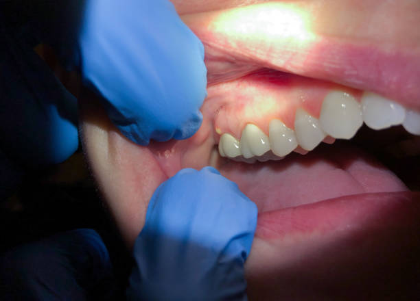 Best Walk-In Emergency Dentist in Sedalia, MO